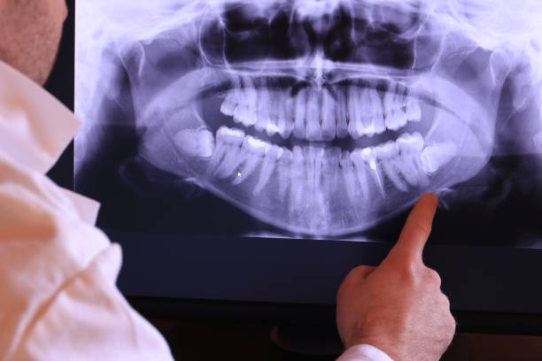Best Emergency Dental Extractions in Loudon, TN