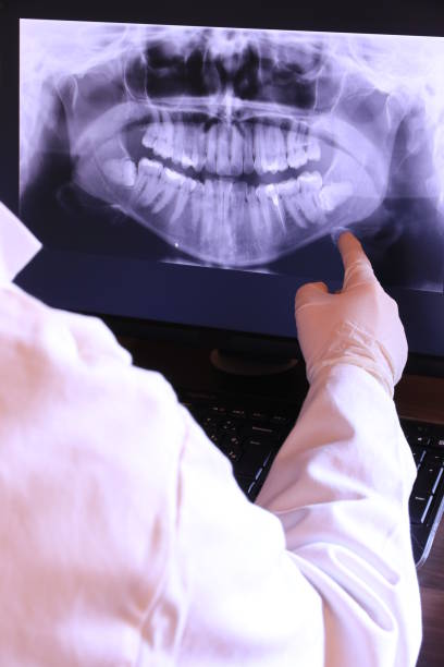 Best Emergency Dentist for Knocked-Out Tooth in Loudon, TN