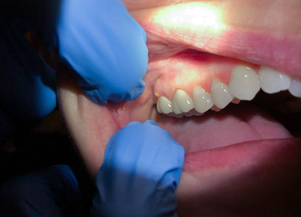 Best Pediatric Emergency Dentist in Loudon, TN